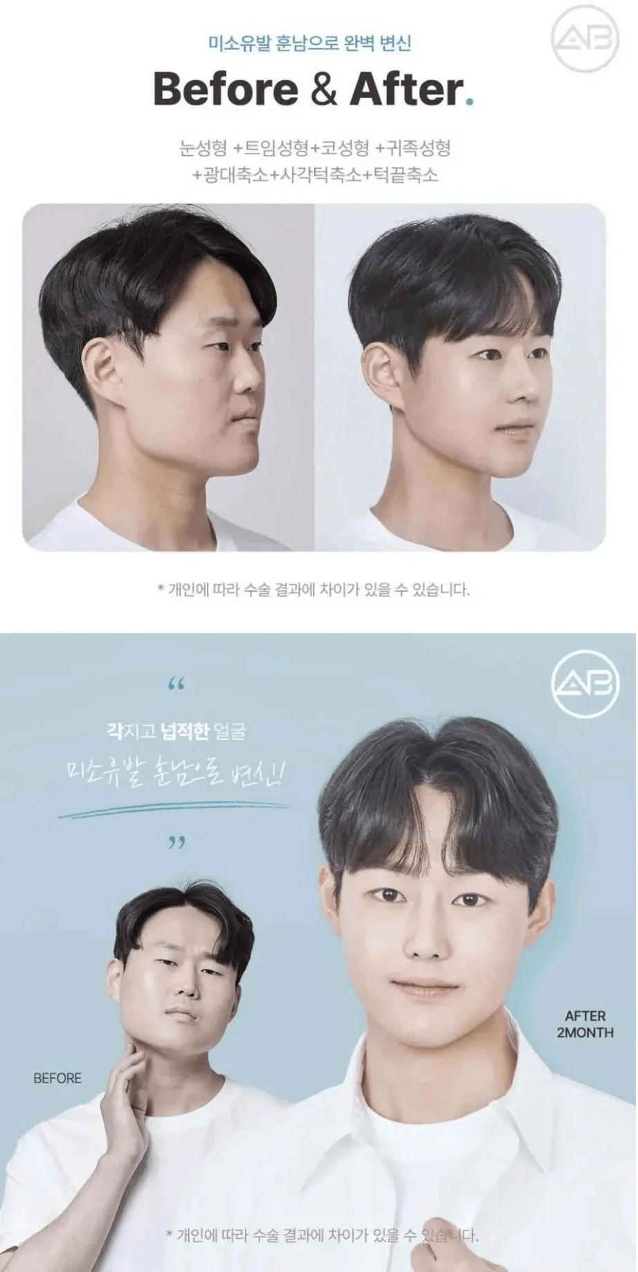 [이슈/유머]요즘 성형은 어떰